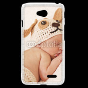 Coque LG L70 Bébé à la sieste 
