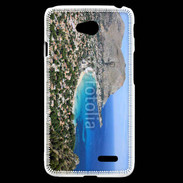 Coque LG L70 Baie de Mondello- Sicilze Italie