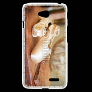 Coque LG L70 Chausson danse classique 6