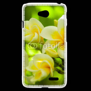 Coque LG L70 Fleurs Frangipane