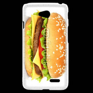 Coque LG L70 Hamburger