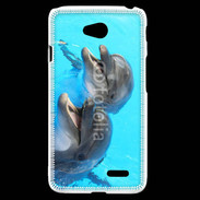 Coque LG L70 Duo de dauphins