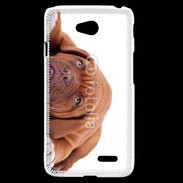 Coque LG L70 Mastiff marron