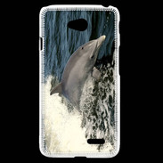 Coque LG L70 Coque Dauphin et vague