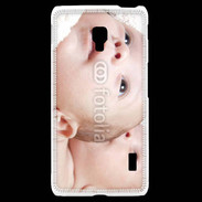 Coque LG F6 Têtes jumeaux