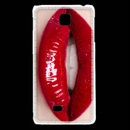 Coque LG F5 Passion rouge à lèvres 5
