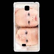 Coque LG F5 Jumeaux 6