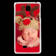 Coque LG F5 Bébé Rennes