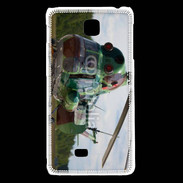 Coque LG F5 Hélicoptère militaire