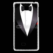 Coque LG F5 Illustration smoking noir