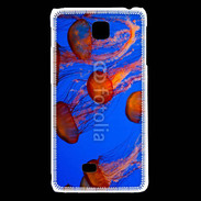 Coque LG F5 Bal de méduses