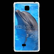 Coque LG F5 Dauphin 2