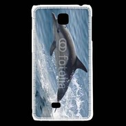 Coque LG F5 Dauphin 3