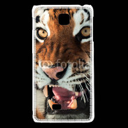 Coque LG F5 Tigre de Sibérie 1