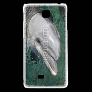 Coque LG F5 Tête de dauphin 1