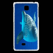 Coque LG F5 Portrait de dauphin 5