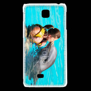 Coque LG F5 Bisou de dauphin