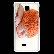 Coque LG F5 Bébé 7