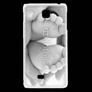Coque LG F5 Pieds de bébé noir et blanc