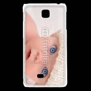 Coque LG F5 Humour de bébé 3