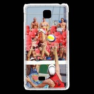 Coque LG F5 Beach volley 3