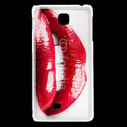 Coque LG F5 Bouche sexy gloss rouge