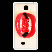 Coque LG F5 Bouche et nounours PR