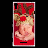 Coque Sony Xperia T3 Bébé Rennes