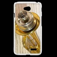 Coque LG L70 Trompette 3 
