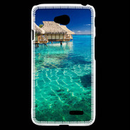 Coque LG L70 Bungalow sur l'eau des tropiques