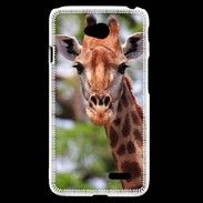 Coque LG L70 Portrait d'une Giraffe