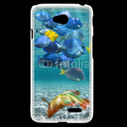 Coque LG L70 poisson tropical 3
