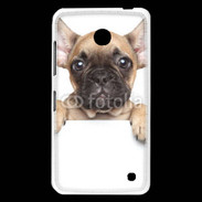 Coque Nokia Lumia 630 chien 10