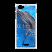 Coque Sony Xpéria J Dauphin 2