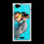 Coque Sony Xpéria J Bisou de dauphin