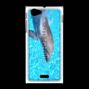 Coque Sony Xpéria J Dauphin 21