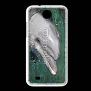 Coque HTC Desire 300 Tête de dauphin 1