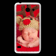 Coque Huawei Y550 Bébé Rennes