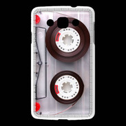 Coque LG L60 Cassette audio de musique
