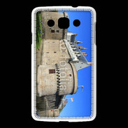 Coque LG L60 Château des ducs de Bretagne