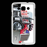 Coque LG L60 Dessin de camion