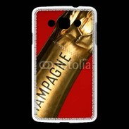 Coque LG L60 Luxe Champagne 5