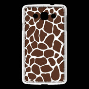 Coque LG L60 motif girafe 2