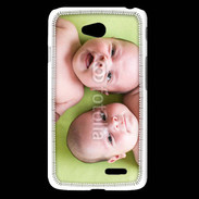 Coque LG L65 Duo bébé