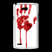 Coque LG L80 Trace de sang