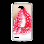 Coque LG L80 Bouche sucrée
