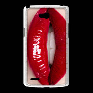 Coque LG L80 Passion rouge à lèvres 5