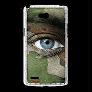 Coque LG L80 Militaire 3