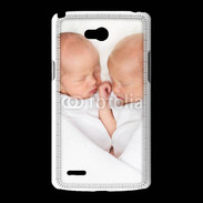 Coque LG L80 Duo de bébés qui dorment 2
