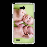 Coque LG L80 Jumeaux 2